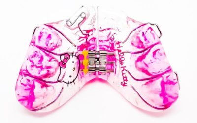 Customiza tu aparato dental!