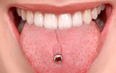 Los piercings orales ¿conoces los riesgos de llevarlos?